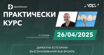 26 април 2025 г. - Директни естетични възстановявания във фронта, гр. Пловдив